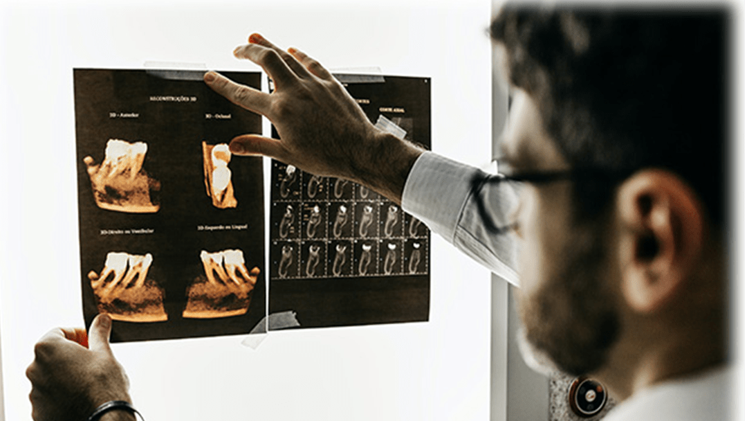A man is looking at an x-ray image.