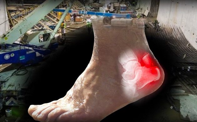 A foot with red spots on it and some buildings in the background